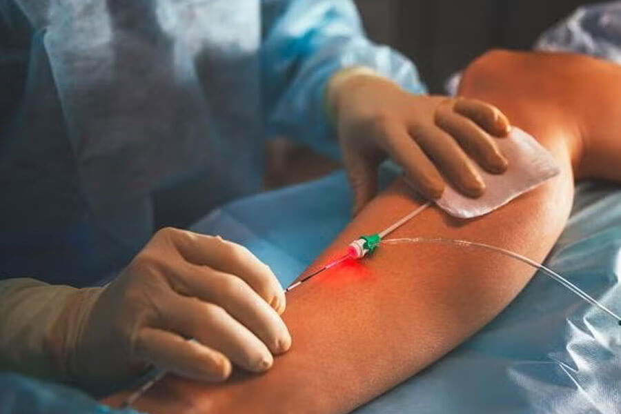 img_web_cardiovasc_servicios_especialidades_cirugia_endivascular_vascular_angiologia_2